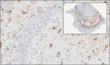 Flagship Biosciences Launches Quantitative Histopathology Services in...
